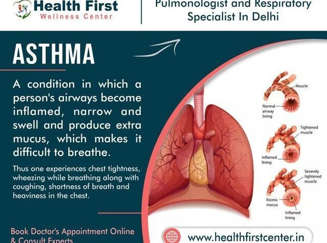 Best Asthma Doctor in Delhi