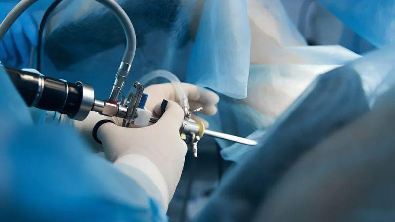 Best Hysteroscopic Surgeon in Dubai