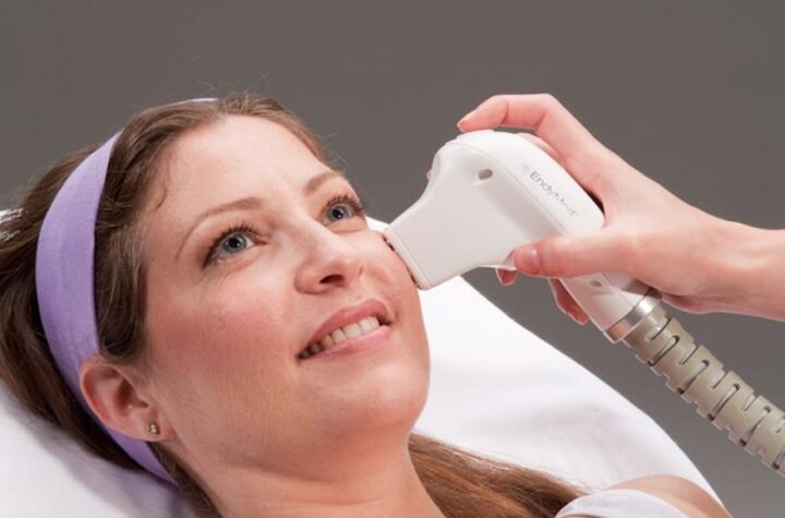 Endymed Skin Resurfacing