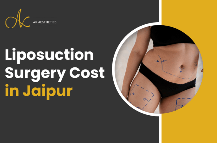 Liposuction Surgery Cost in Jaipur - Dr Akangsha Sharma