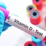 Vitamin D Test