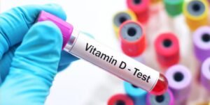 Vitamin D Test