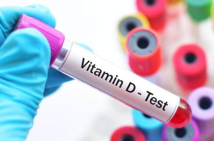 Vitamin D Test