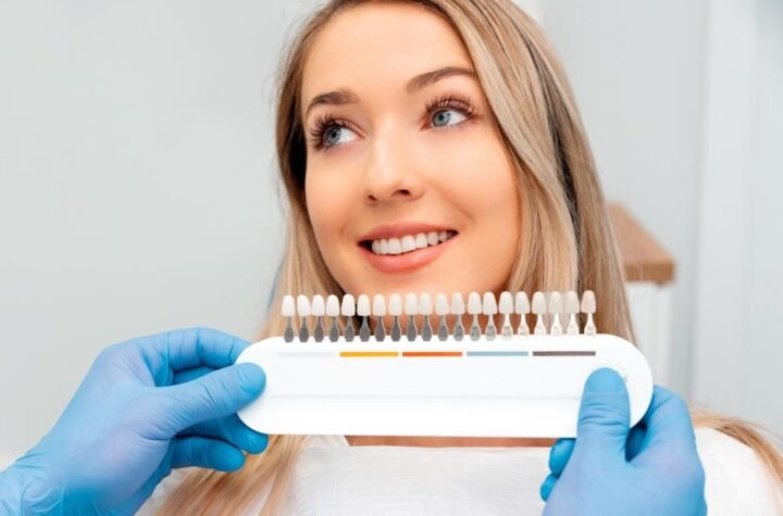 cosmetic veneers in Roslindale